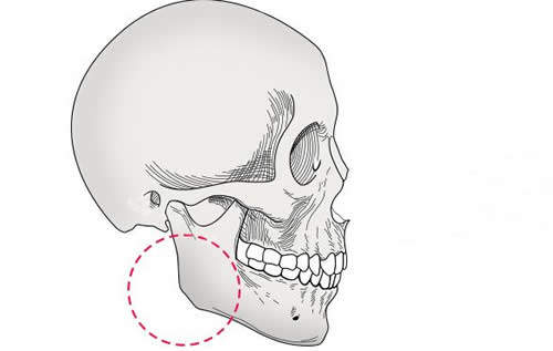 下颌角部位骨骼示意图