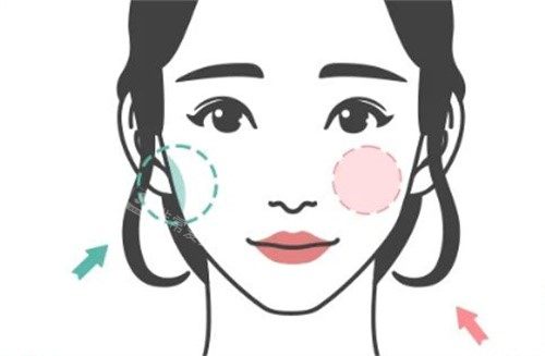 整形卡通示意图 整形卡通示意图