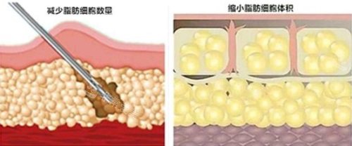 脂肪细胞示意图 脂肪细胞示意图