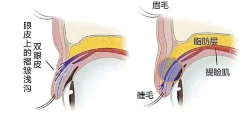 双眼皮和单眼皮的组织构造照片 双眼皮和单眼皮的组织构造照片