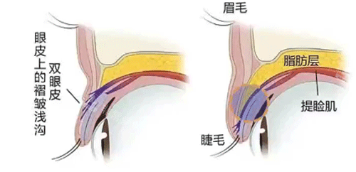 雙眼皮和單眼皮的組織構(gòu)造照片