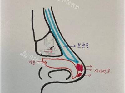 韩国葡聚糖生物肋骨鼻内部剖视
