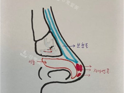 韓國葡聚糖生物肋骨鼻內(nèi)部剖視