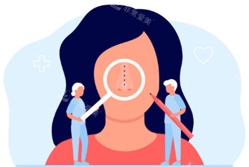 隆鼻手術示意圖