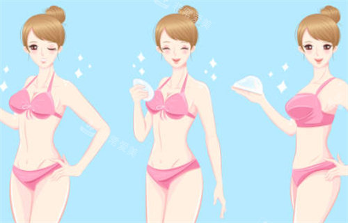 隆胸对比示意图 隆胸对比示意图