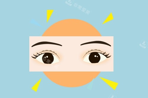 切開雙眼皮手術(shù)宣傳圖