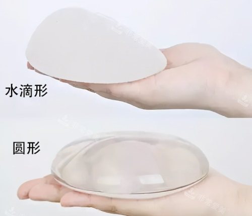 假体形状示意图 假体形状示意图