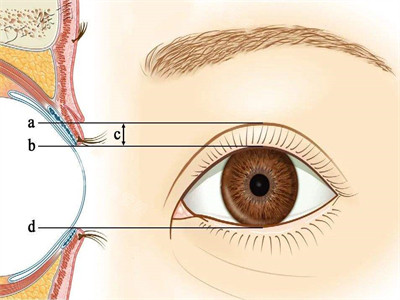 双眼皮与眼部比例透视