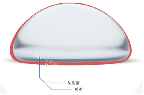 韩国WOOA整形外科隆胸示意图