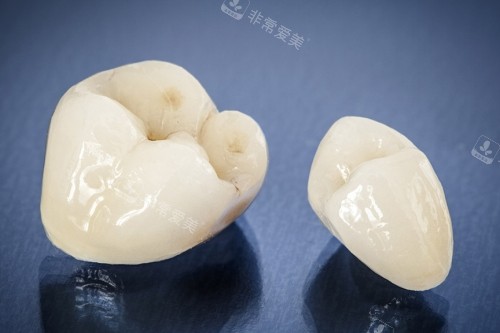 牙齿模型展示图 牙齿模型展示图