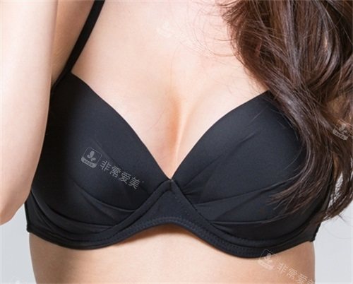 分析韩国Faceplus整形医院胸部整形特色,隆胸做的还不错哦!