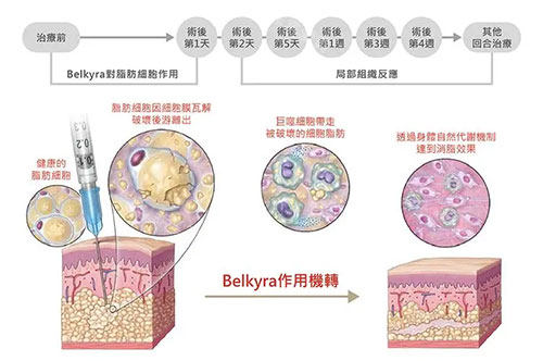 脂肪细胞溶解过程图