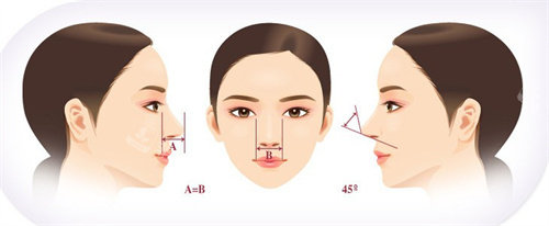 隆鼻对比示意图