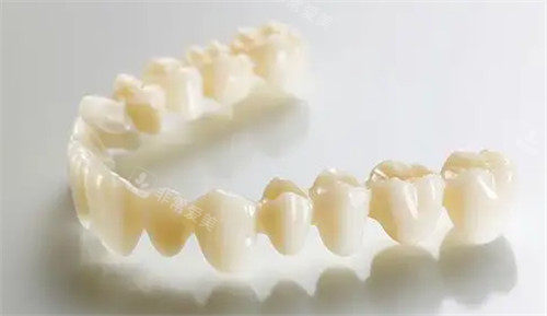 全瓷牙冠照片 全瓷牙冠照片