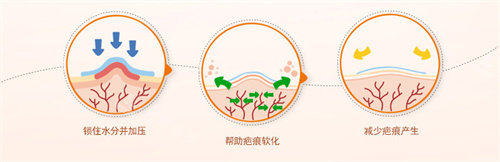 皮膚疤痕示意圖 皮膚疤痕示意圖