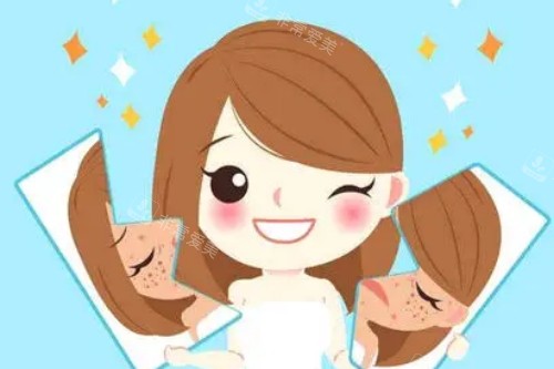 祛斑项目卡通图 祛斑项目卡通图