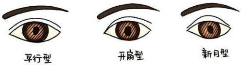 不同类型的双眼皮 不同类型的双眼皮