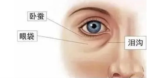 眼袋位置示意图 眼袋位置示意图