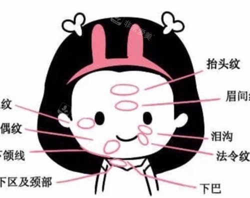 面部衰老示意图 面部衰老示意图