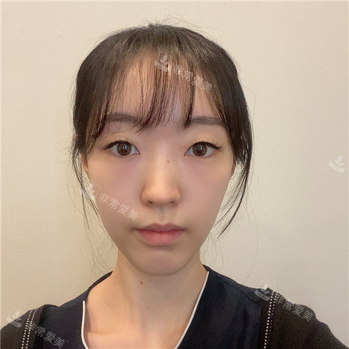 1671787415600304.jpg 術(shù)前(2).jpg