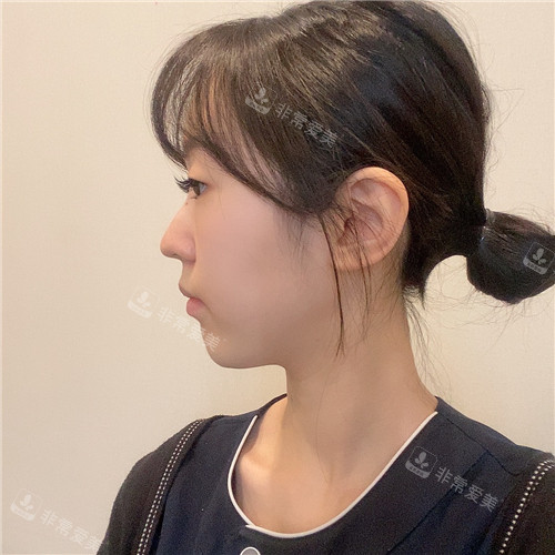 1671787435331052.jpg 術(shù)前(1).jpg