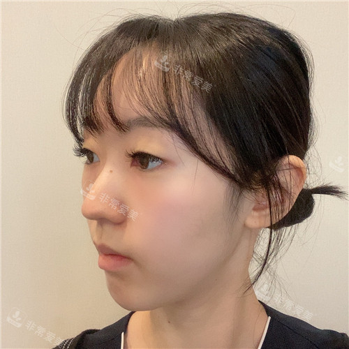 1671787444762502.jpg 術(shù)前(4).jpg