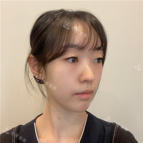 1671787454987181.jpg 術(shù)前(3).jpg