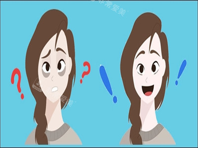 去黑眼圈眼袋前后对比