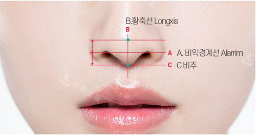 鼻尖整形标准图示