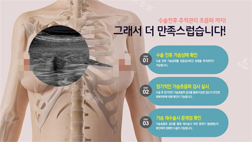 韩国波轮美整形隆胸方法展示图