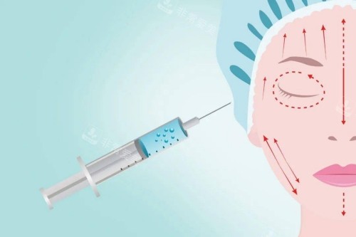 注射整形卡通图 注射整形卡通图