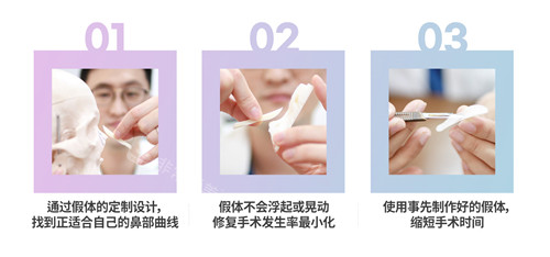 韓國樂日LARA整形外科3D打印鼻部整形特點(diǎn)