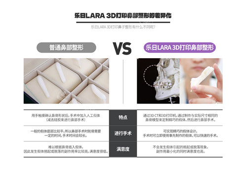 韓國樂日LARA整形外科3D打印鼻部整形優(yōu)勢對比介紹