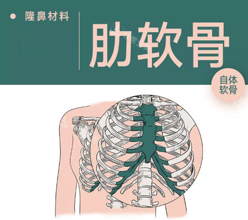 肋軟骨隆鼻材料 肋軟骨隆鼻材料
