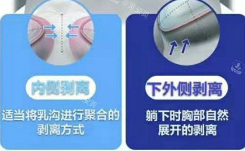 韓國原辰隆胸優(yōu)勢(shì)介紹