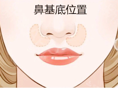 鼻基底位置圖示 鼻基底位置圖示