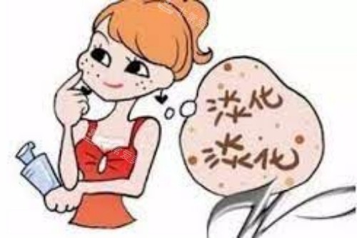 果酸換膚卡通圖
