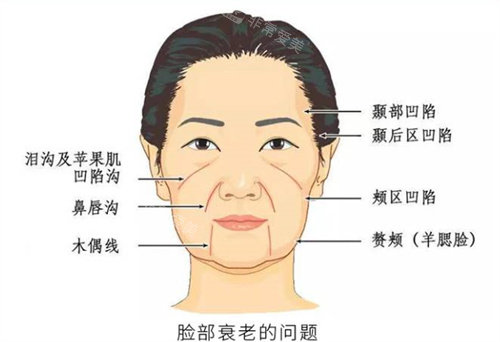 面部衰老示意图