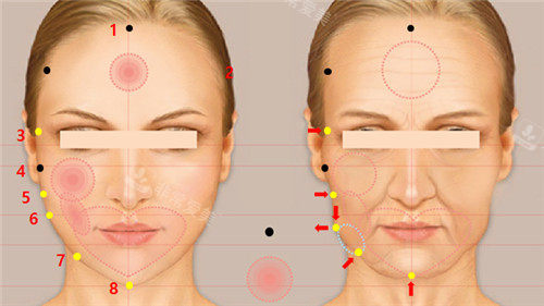 面部抗衰的部位圖