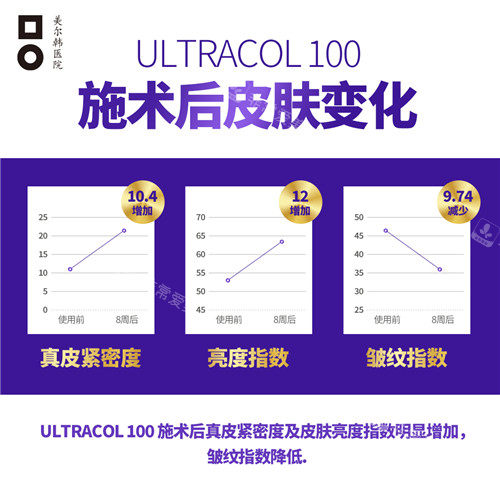 ULTRACOL注射之后皮膚變化