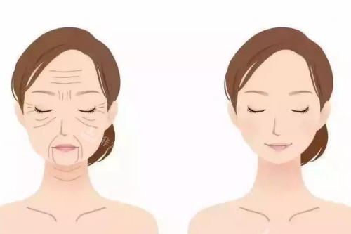 抗衰老項(xiàng)目對比