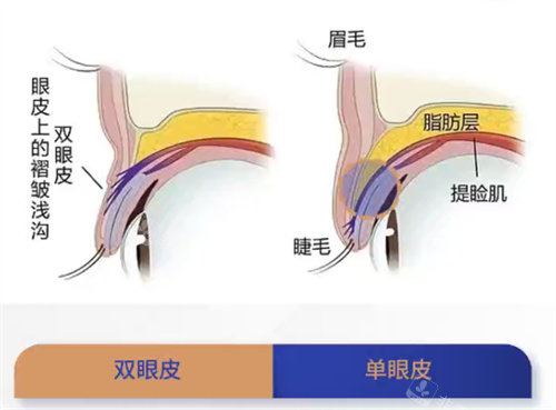 大连刘志刚双眼皮做的怎样?刘志刚高难度眼修复做得好！