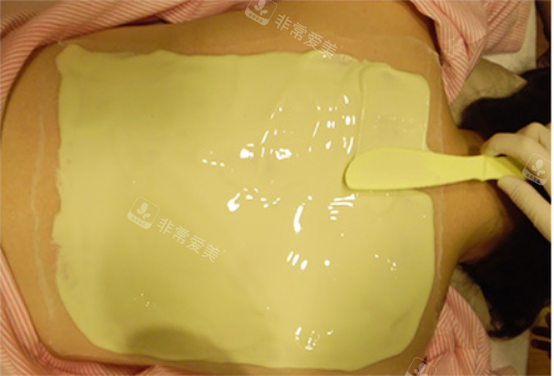 韓國美爾韓醫(yī)院背部痘痘治療 韓國美爾韓醫(yī)院背部痘痘治療