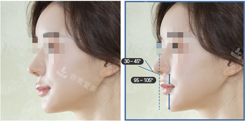 韩国温度人中鼻整形打造漂亮的45°角轮廓,平衡鼻子年轻精致