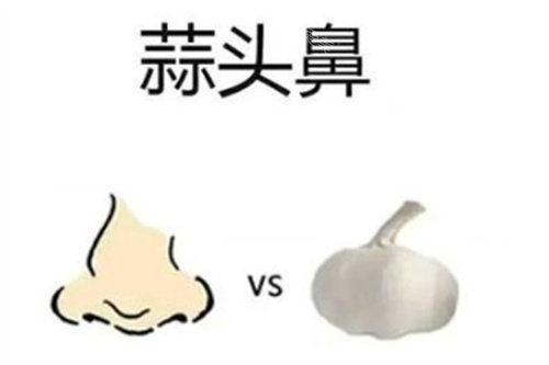 隆鼻卡通图 隆鼻卡通图