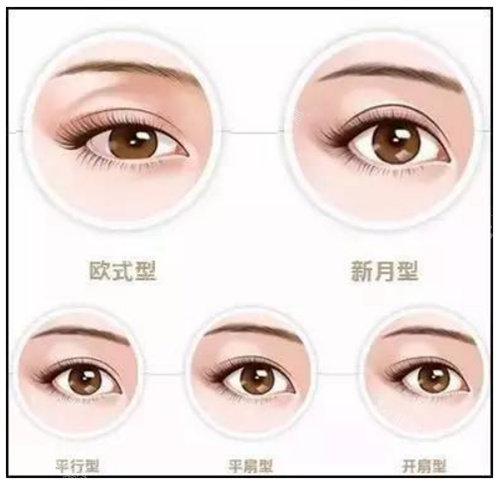 雙眼皮類型圖示 雙眼皮類型圖示