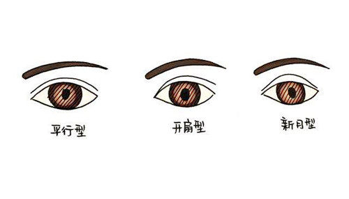雙眼皮類型圖示 雙眼皮類型圖示