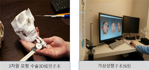 韩国伊美芝整形外科轮廓手术模拟图