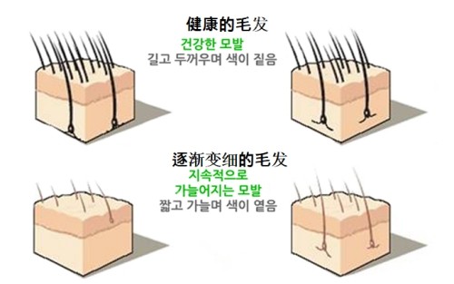 健康毛发与变细的毛发