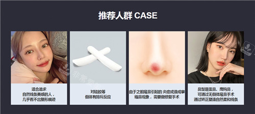 韓國GNG醫(yī)院無假體隆鼻手術(shù)適應(yīng)癥 韓國GNG醫(yī)院無假體隆鼻手術(shù)適應(yīng)癥